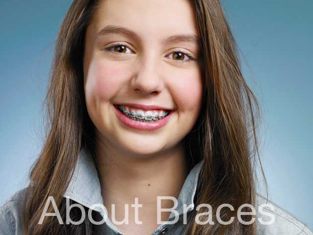 Caring for your braces